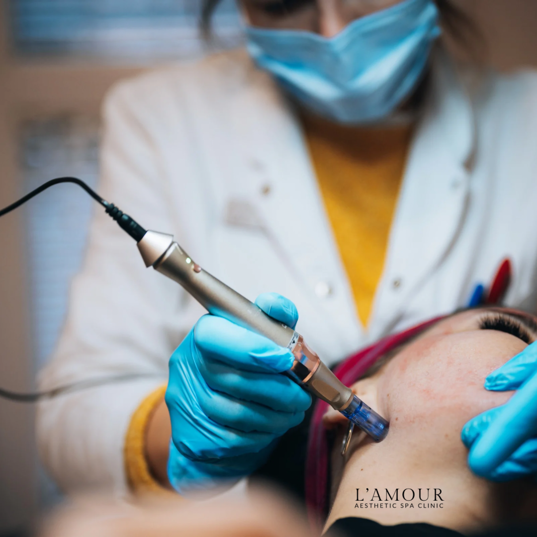 Microneddle - 1 area